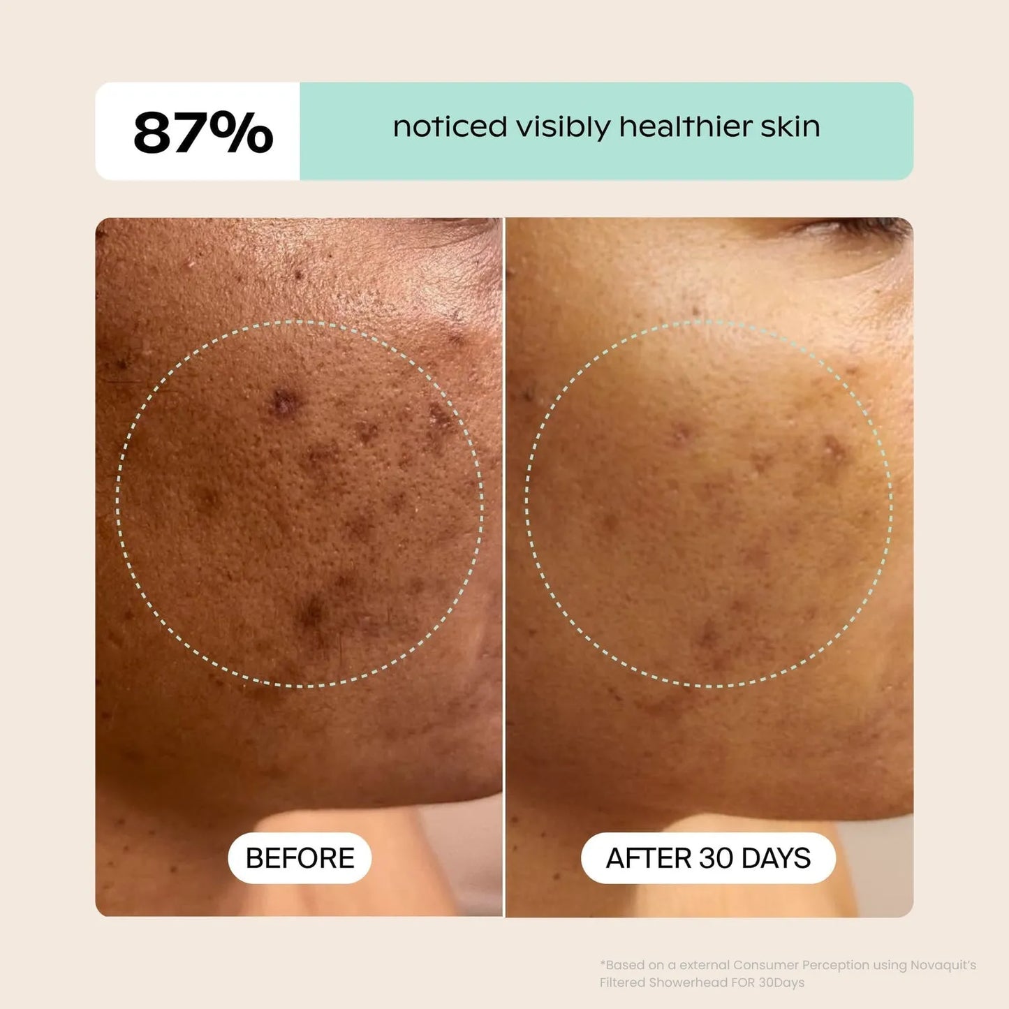 HEALTHIER HAIR AND SOFTER SKIN IN 30 DAYS