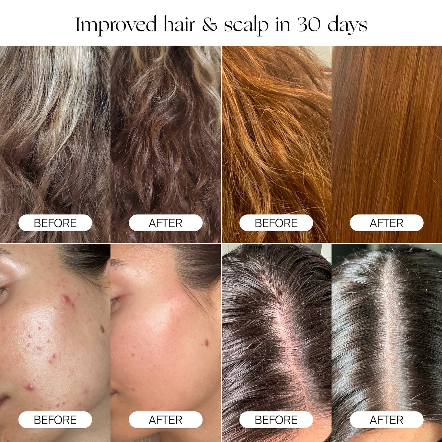 HEALTHIER HAIR AND SOFTER SKIN IN 30 DAYS
