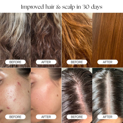 HEALTHIER HAIR AND SOFTER SKIN IN 30 DAYS
