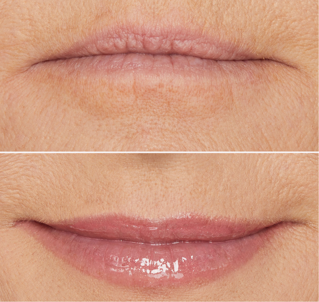 Fill Your Lips In Less Than 5 Minutes