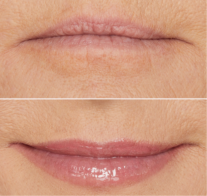 Fill Your Lips In Less Than 5 Minutes