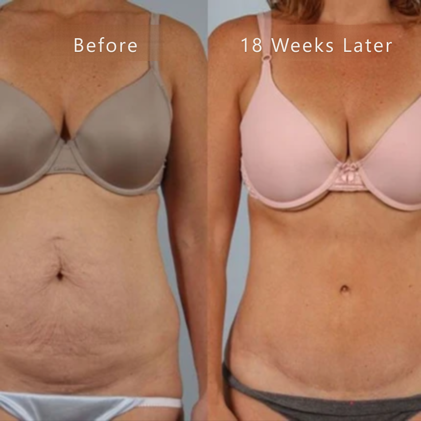 Fade and Smooth Your Scars — Just 60 Seconds a Day